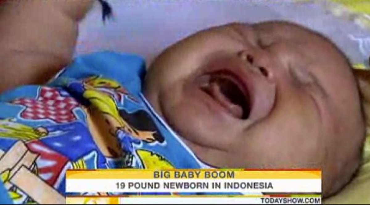 Andrew Jacob Cervantez, Who Weighed 15 Pounds At Birth, Is One Of The