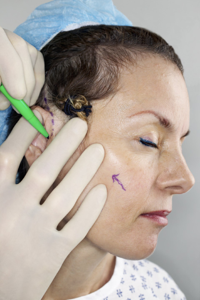 The Most Popular Plastic Surgeries In America 24/7 Wall St. HuffPost