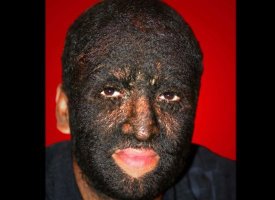 Larry Gomez: The Wolf Boy