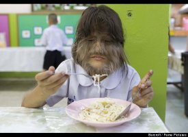 Hairiest Girl in the World