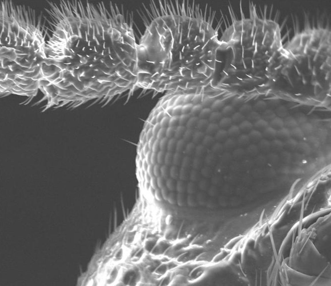 Electron Microscope Photos Show Spider Skin, Coffee, Dandelions, Tomato