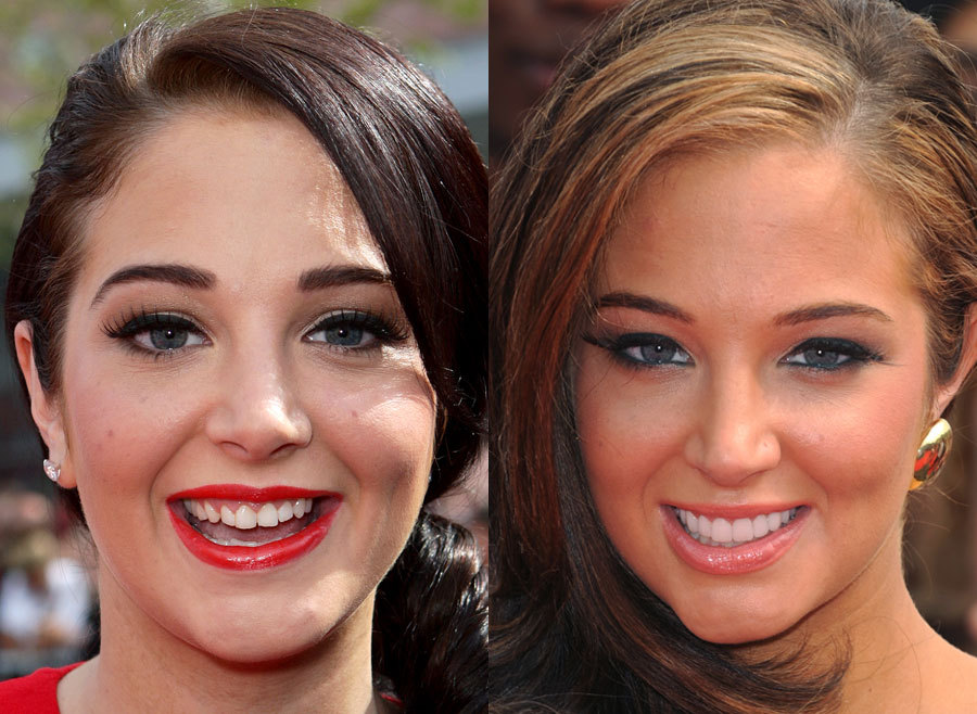 1000+ Images About Celebrity Smile Transformations On Pinterest ...