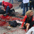 Boston Marathon Explosion 