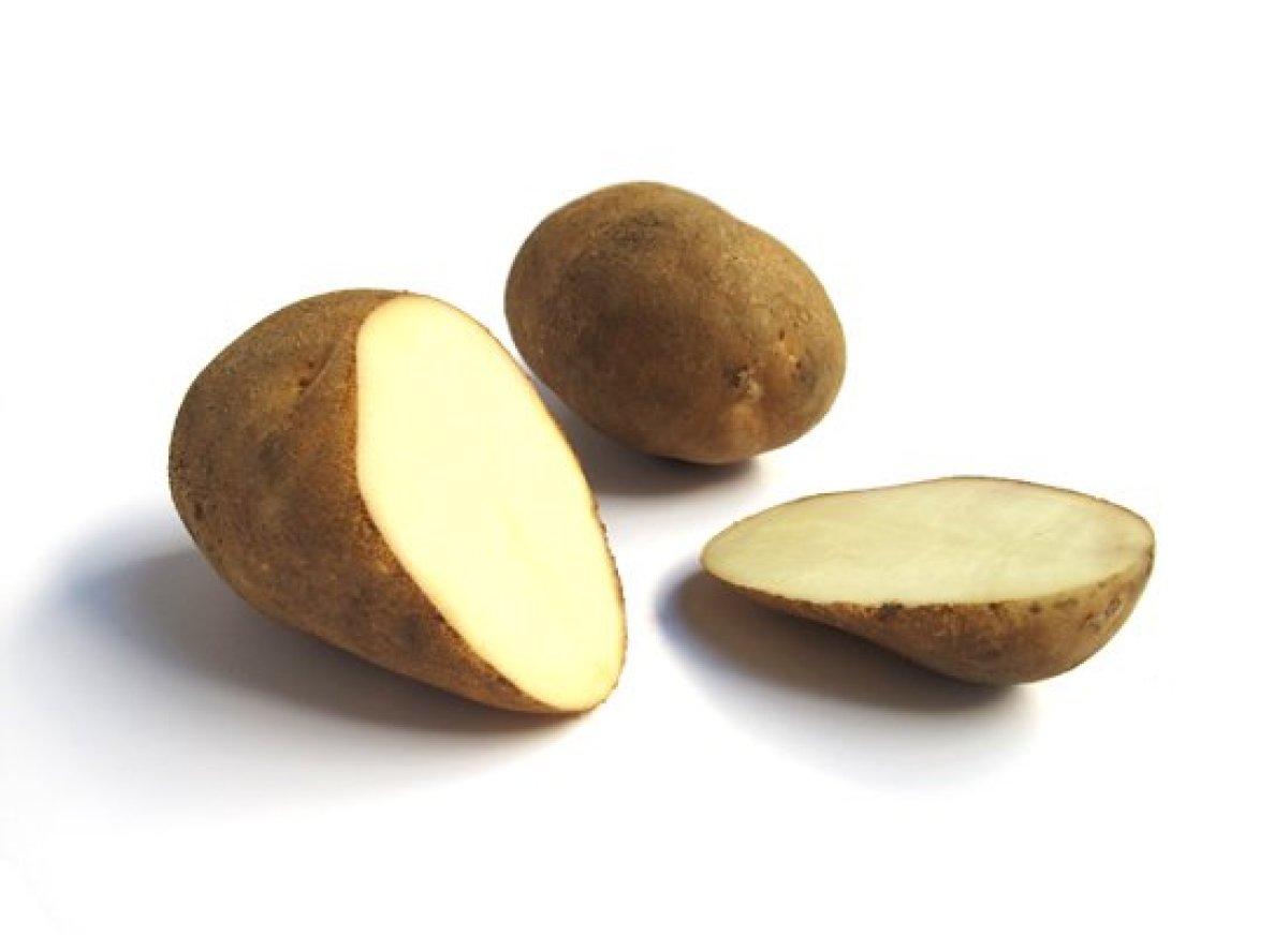 ↟Supernal Health↟ — A Guide To Every Type Of Potato You Need To Know