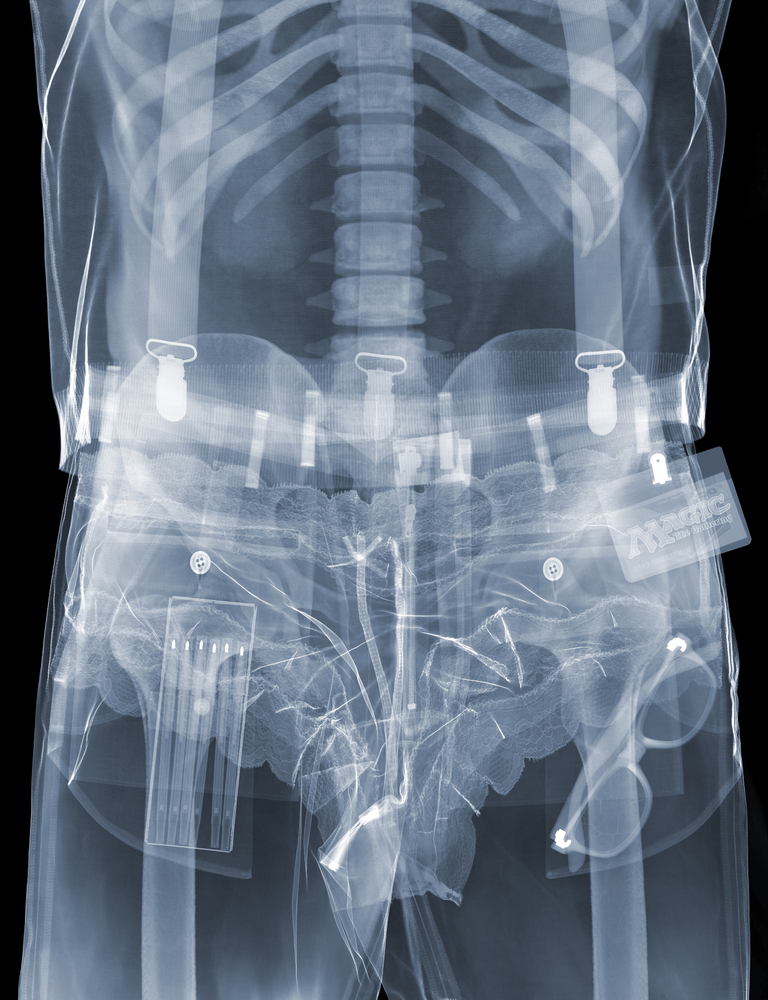 X Ray Voyeurism Nick Veasey S Images Explore What Lies Beneath