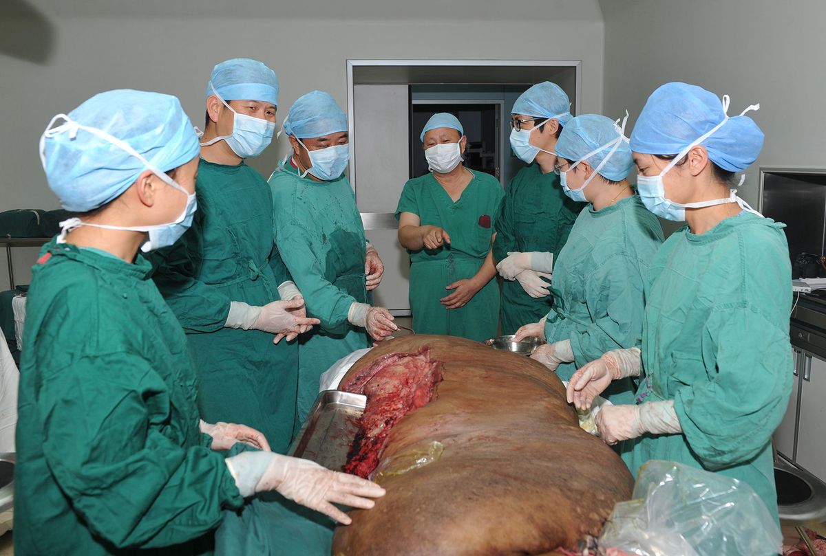 slide 357235 3945127 free Κίνα: Αφαιρέθηκε ο μεγαλύτερος όγκος που αναπτύχθηκε ποτέ σε άνθρωπο Zύγιζε 110 κιλά και χρειάστηκαν 9 γιατροί για την επέμβαση!