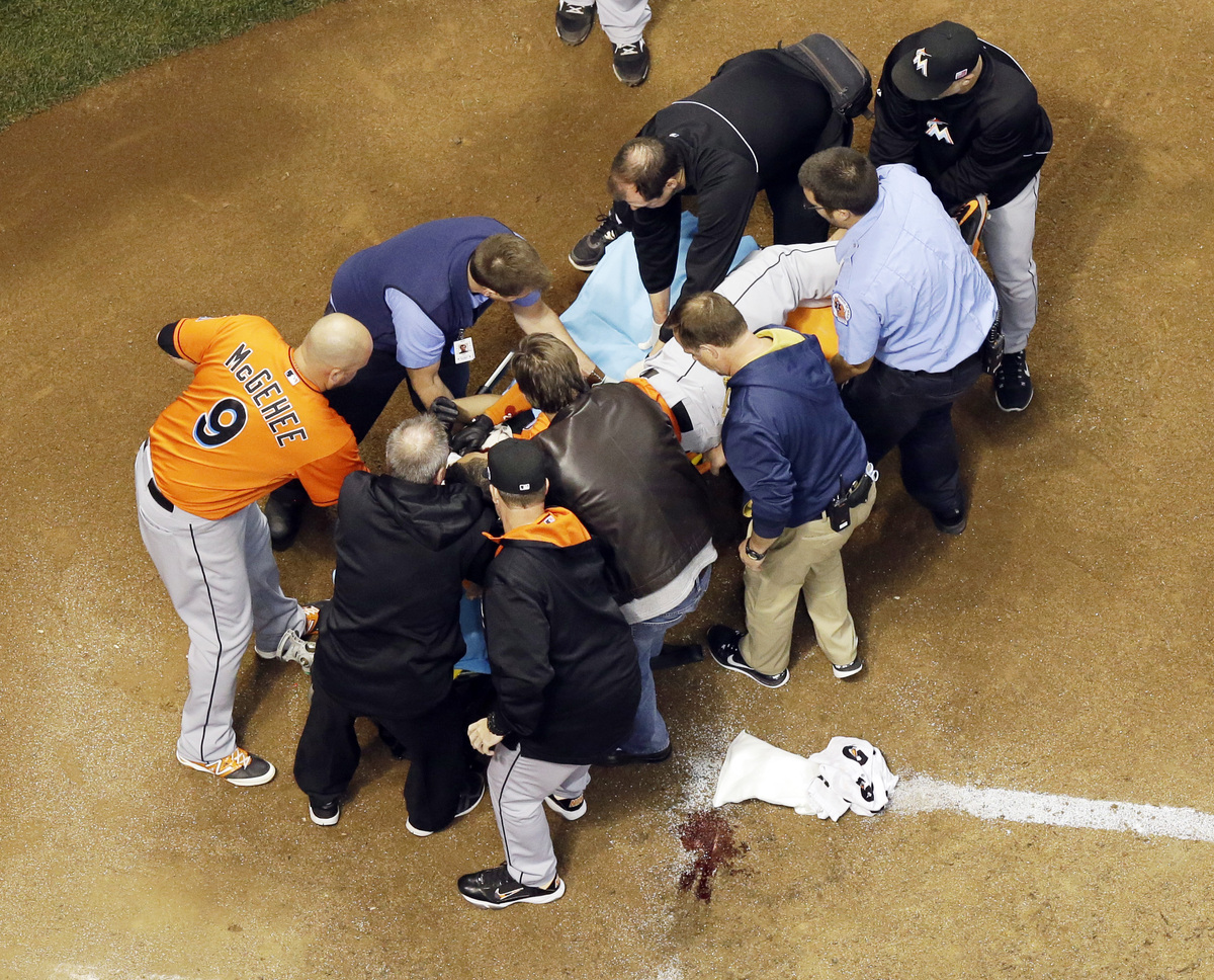 Giancarlo Stanton, Miami Marlins Slugger, Shows Off Grouesome Facial ...