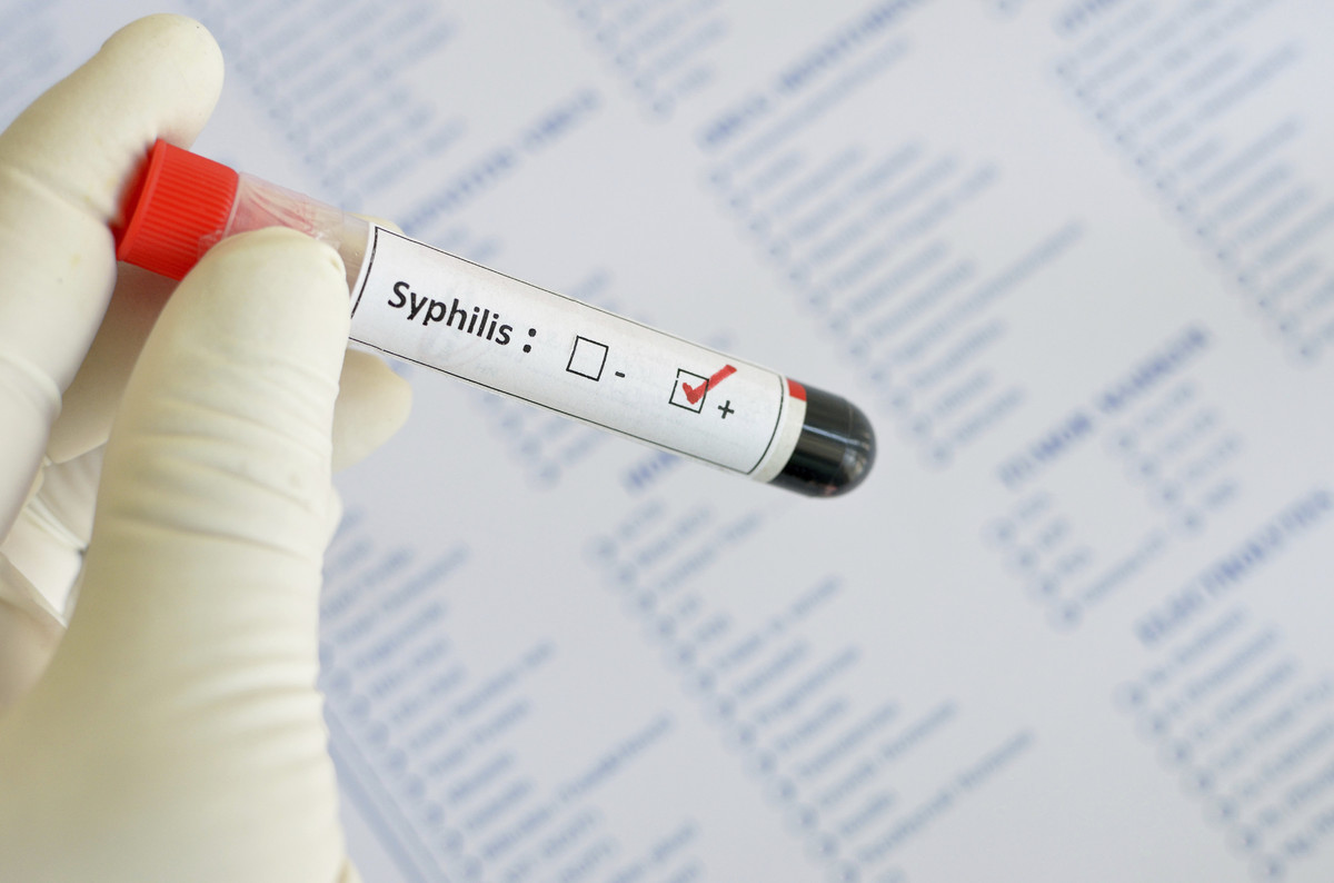 обнаружен сифилис