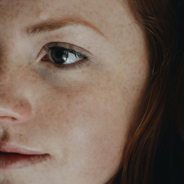 31 Powerful Photos That Prove Freckles Are Gorgeous Huffpost 
