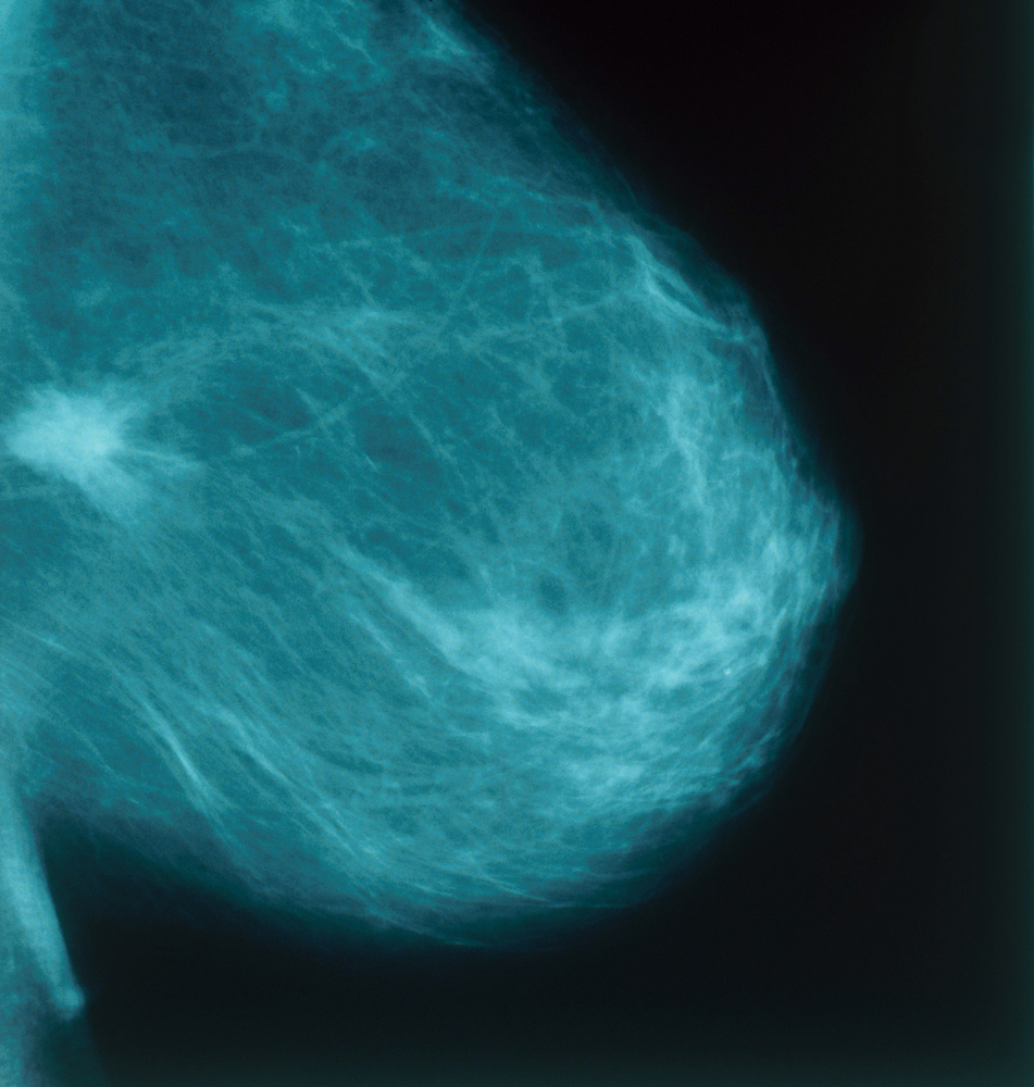 Image Result For Is Breast Painfula Image Result For Is Breast Painfula