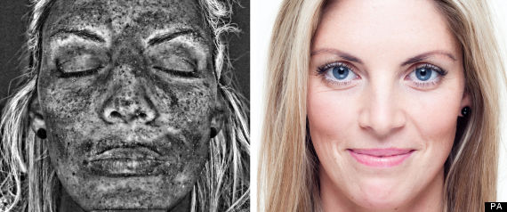 Sunbed