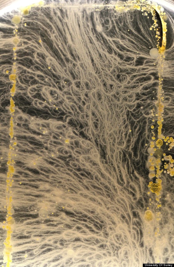 bacteria phone