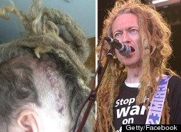Vegetarian Punk Singer Had WHAT Removed From His Brain??