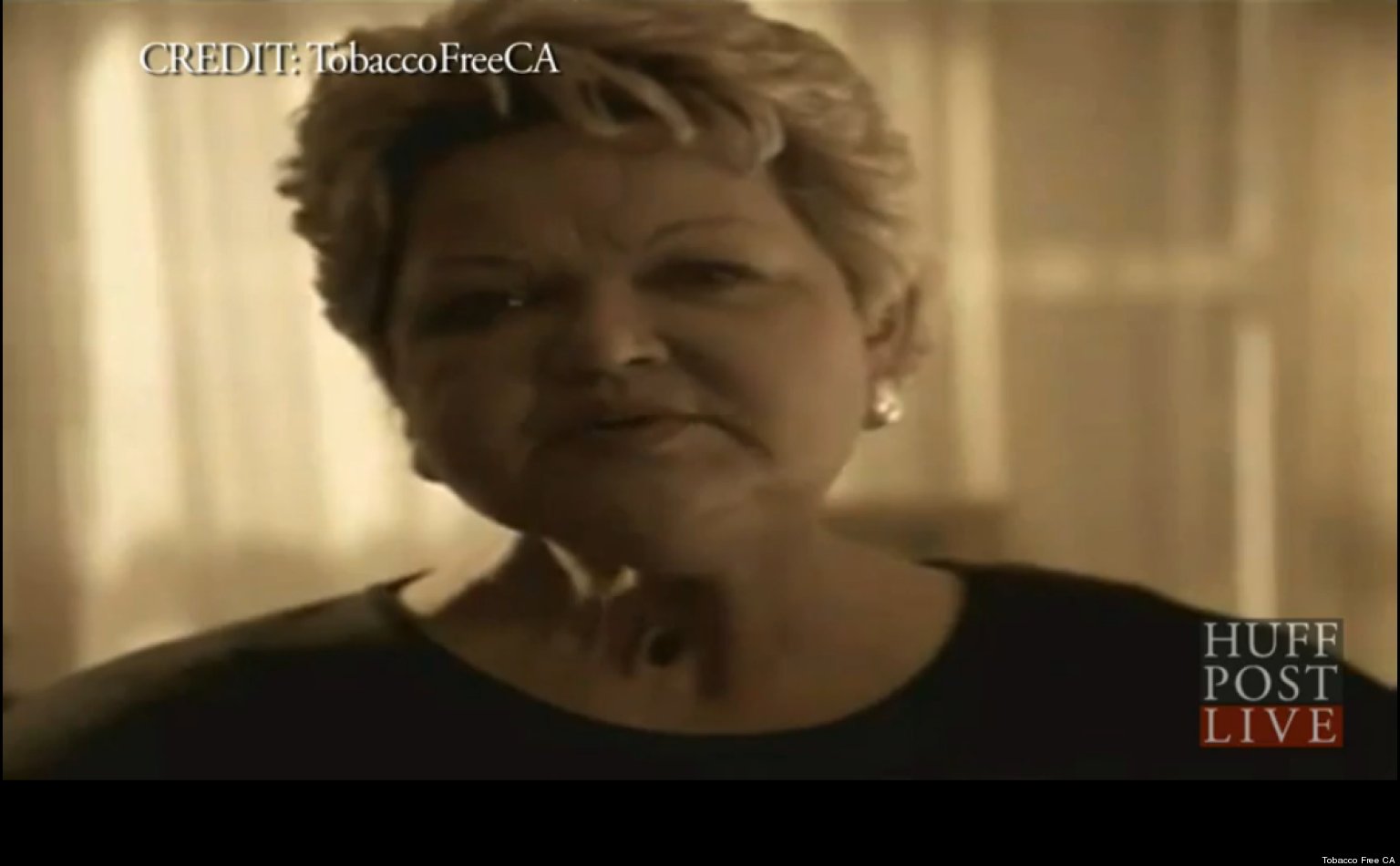 Debi Austin Dead Star of 'Voice Box' AntiSmoking Ad, Dies Of Cancer