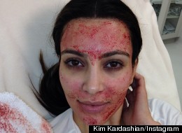 What The HELL IS Going On With Kim Kardashian's Face?