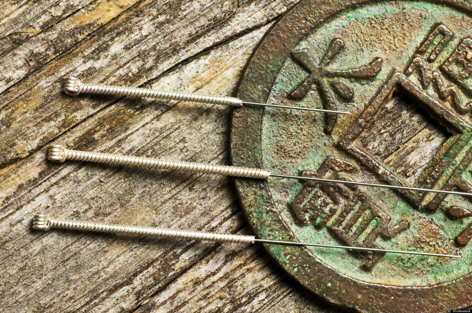 Acupuncture Relieves Stress New Understanding Of Why The Ancient