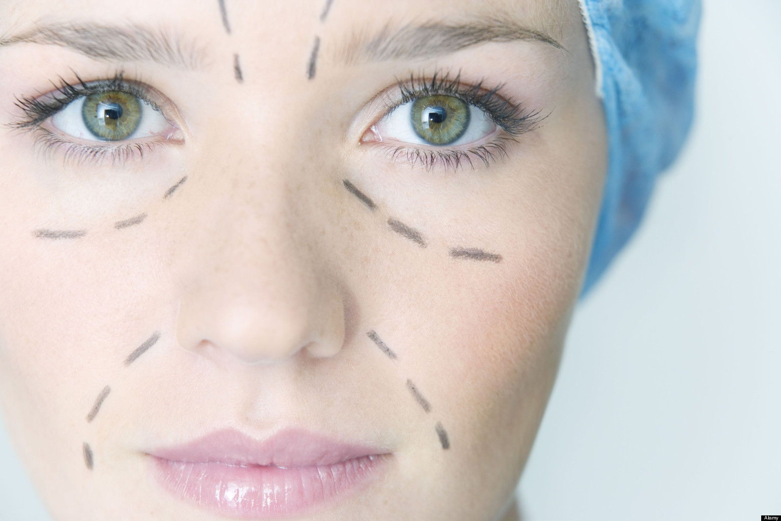 Plastic Surgeons Create Insurance Policy To Cover
