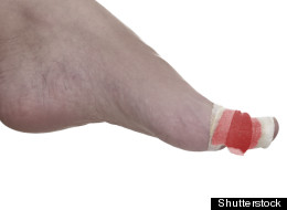 Un gel qui stoppe instantanément les hémorragies
