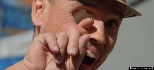 penis in eye socket Agy sex clips