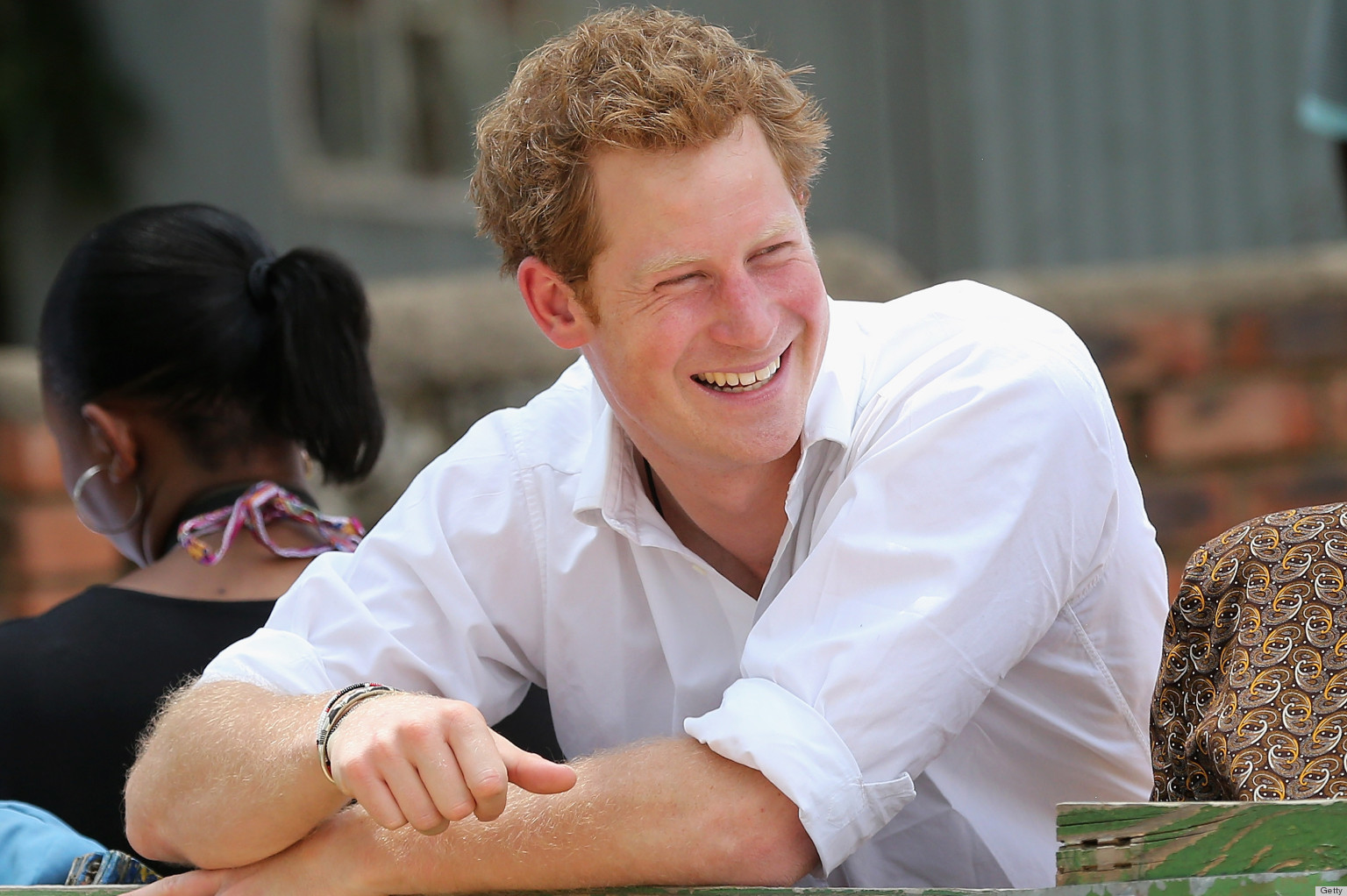 Prince Harry Balding Like Fellow Royal Men, Says Hair Loss Expert