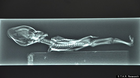 atacamahumanoidxray