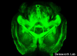 WATCH: 'Stupendous' Brain Technique Hailed By Scientists
