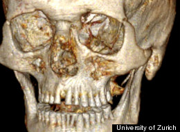 LOOK: Mummy's Mouthful Of Trouble