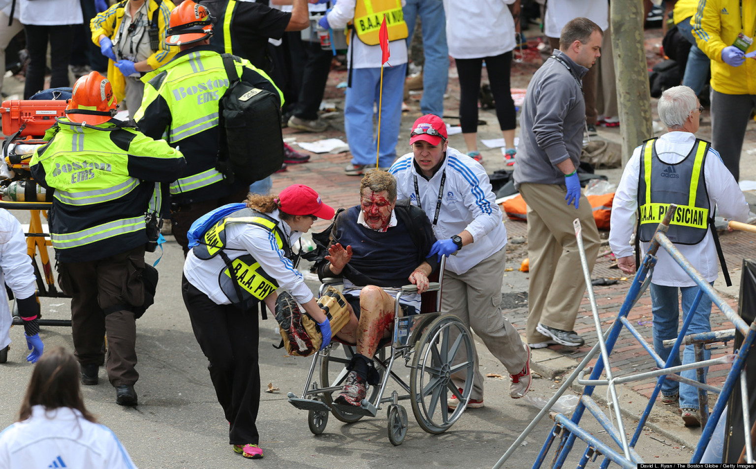Boston Marathon Bombing (GRAPHIC PHOTOS) HuffPost