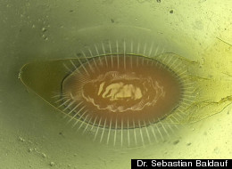Parasite Inspires New Surgical Technique