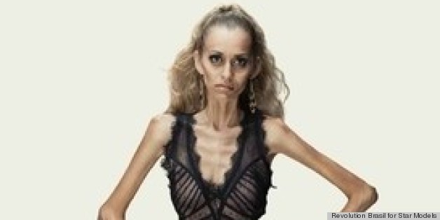 Anti-Anorexia Ads Stun With Tagline 'You Are Not A Sketch' (PHOTOS)