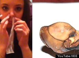 VOTE: Condom Snorting vs. Alleged E.T. Skeleton: The Week In Weird