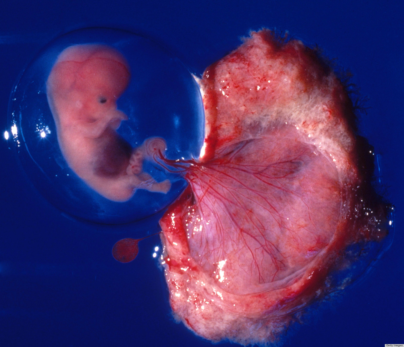 o-PLACENTA-facebook.jpg