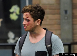 'I Feel Like I've Been Hit By A Bus'