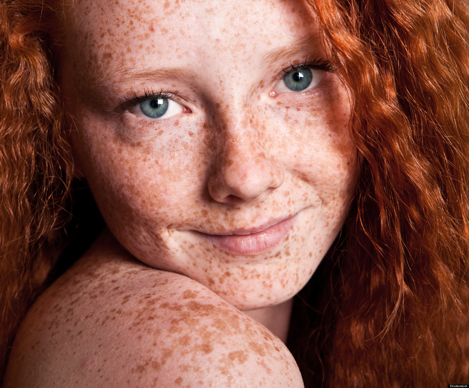 How To Love Freckles: I Went From Hating Mine To Loving ...