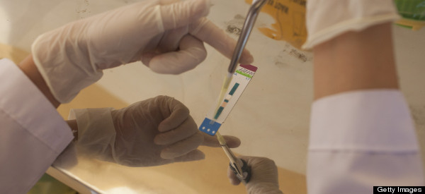Recomiendan examen de VIH para toda la población adulta del país