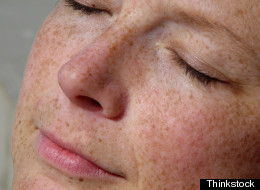 6 Reasons Your Skin Looks 10 Years Older
