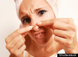how get rid of pimples