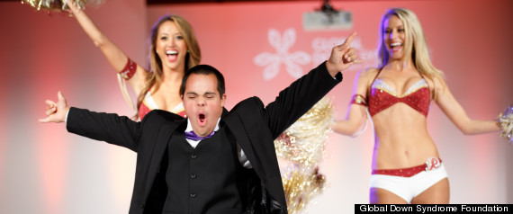  - r-GLOBAL-DOWN-SYNDROME-FOUNDATION-GALA-large570