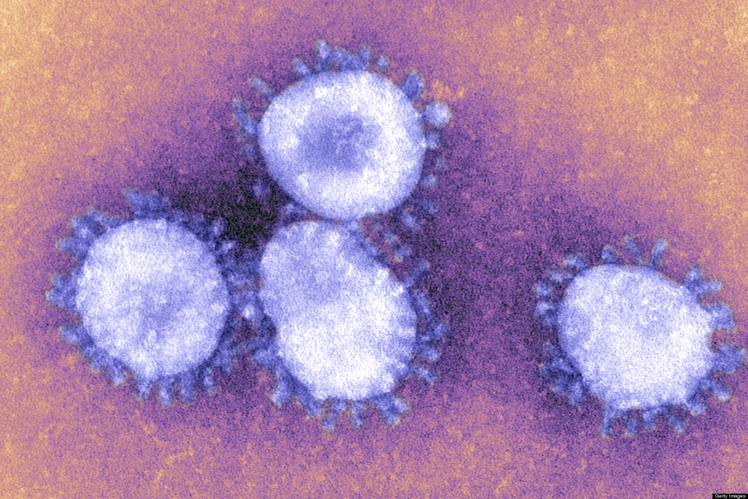 SARS-Like Virus: 4 New Coronavirus Cases Confirmed In Saudi Arabia | HuffPost1536 x 1024