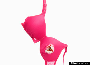 breast cancer