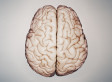 Alzheimer's, HIV/AIDS and Us