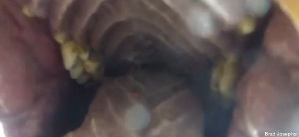 Ce que ça fait d'être mangé par un ours