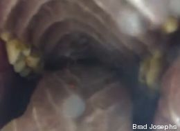 Ce que ça fait d'être mangé par un ours