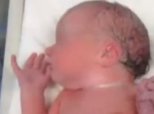 Twins Hold Hands Birth