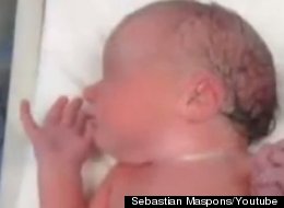 LOOK: Twins Have A Remarkable First Embrace