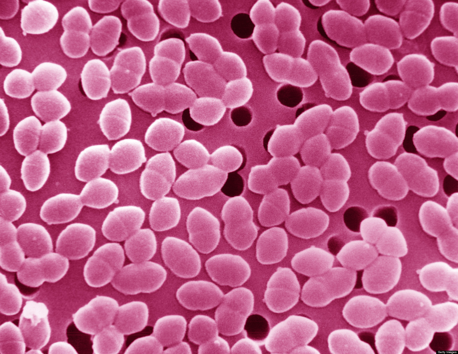 good-gut-bacteria-may-keep-bad-at-bay-huffpost