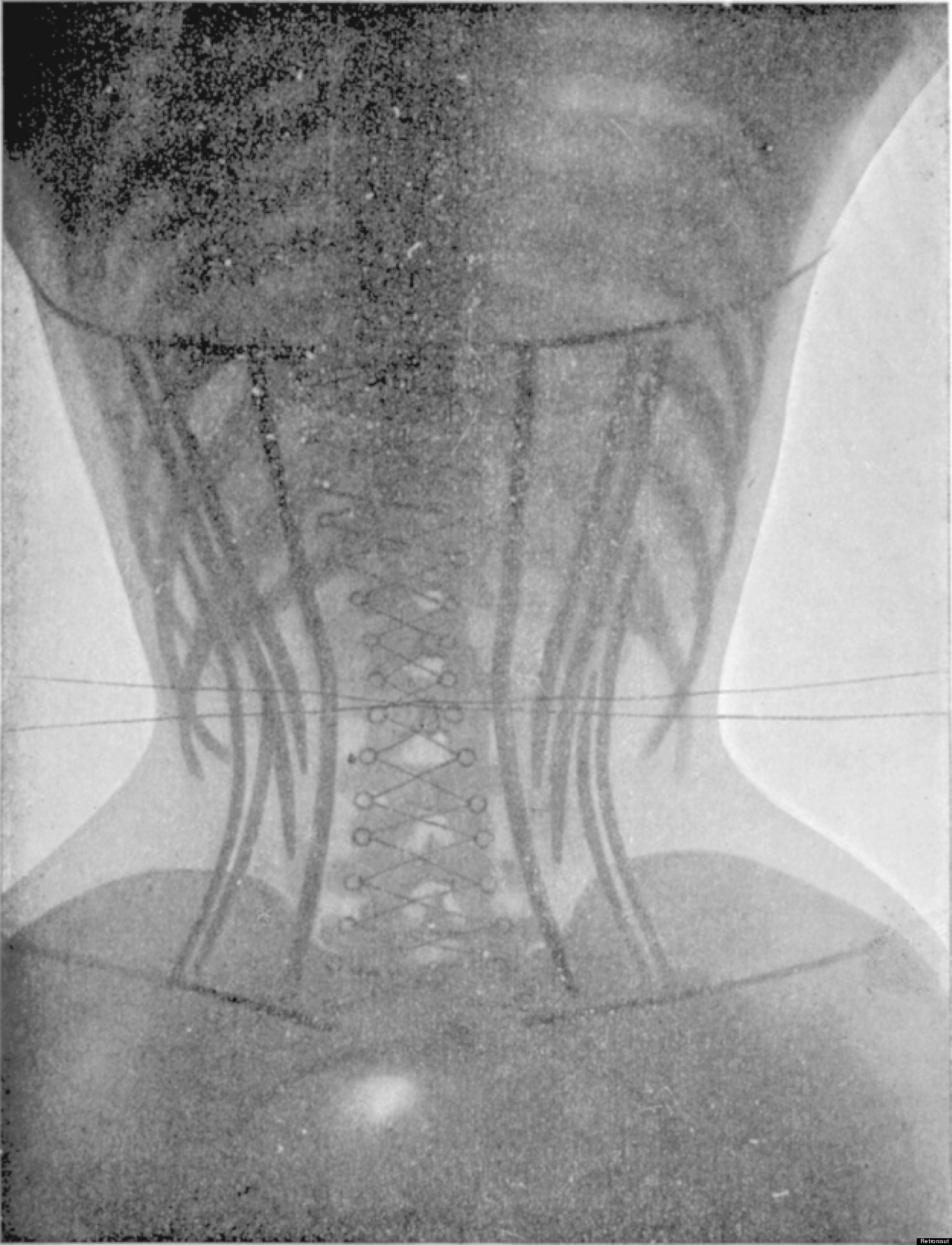 corset-pictures-x-rays-of-women-before-and-after-make-us-extremely