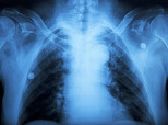 Alabama Mystery Illness