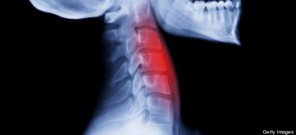 Doctors Save Ohio Boy's Life By 'Printing' Him An Airway Tube