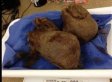 Surgeon's Remove Giant Hairball From Tiger